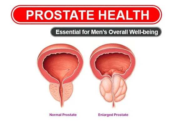 A doctor discussing prostate health screening with a male patient over 50 during a routine check-up.